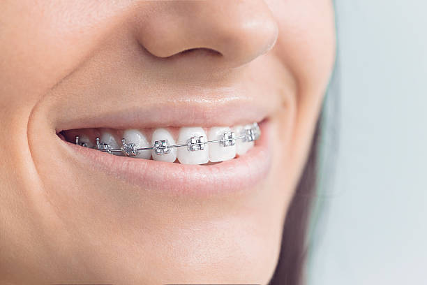 Trusted St Charles, IL  Holistic Dental Services Experts